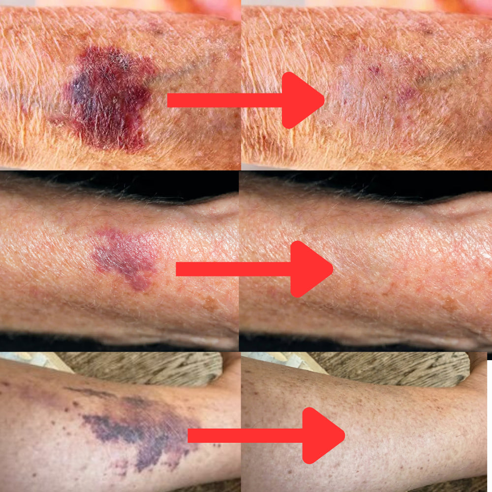 Bruise Defense & Repair Serum
