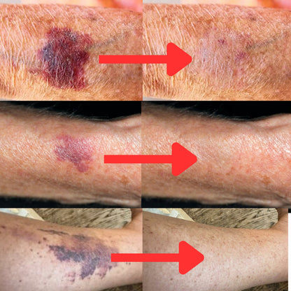 Bruise Defense & Repair Serum